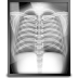 Xray