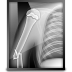 XMedicus journalsystem Osirix